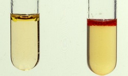 Indole test